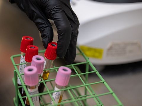 Buisjes bloed in een rek in een laboratorium